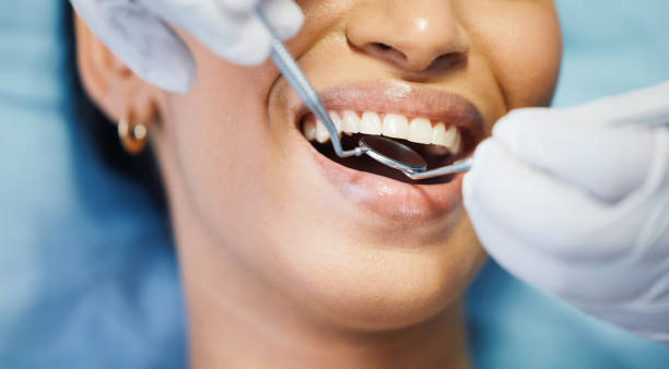 Best Emergency Dental Care for Broken or Chipped Teeth in North Liberty, IN